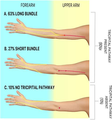 Schematic Demonstrating The Variability In Connections From The Forearm