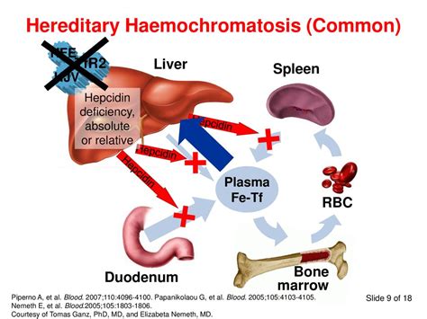 Molecular Pathophysiology Of Iron Disorders Ppt Download