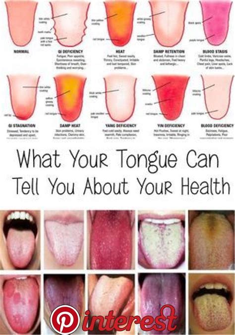 Pale Dog Tongue Color Chart