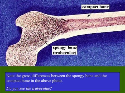 Spongy Bone By Mestangs