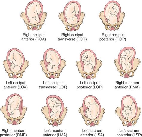 Optimizing Baby Position In Preparation For Birth