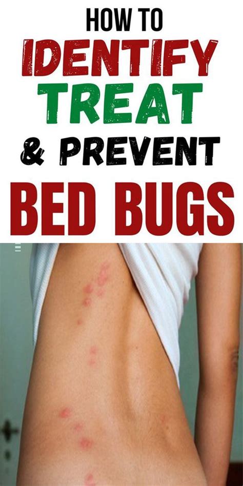 The Bites Of Bedbugs Can Disrupt Your Sleep And Disturb Your Day Bed
