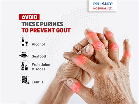 Avoid These Purines To Prevent Gout