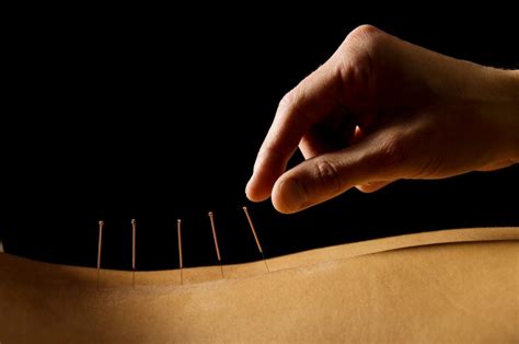 5 Benefits Of Acupuncture Back To Wellness