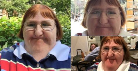 Disabled Woman Told She Is ‘too Ugly To Post Photos Responds Back By