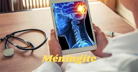 Méningite Symptômes Causes Facteurs Et Complications Beinfirmier