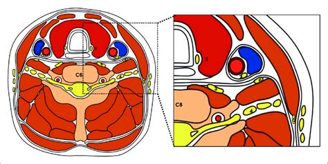 Schematic Drawing Of Transverse Section Of Neck At C6 Level