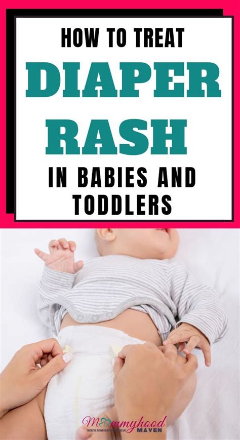How To Treat Diaper Rash In A Newborn Baby Diaper Rash Toddler