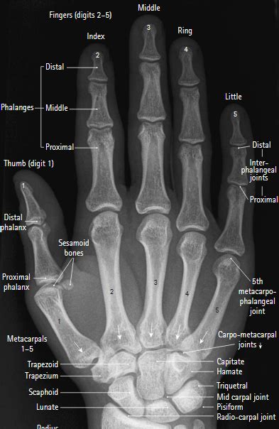 Hands All X Ray Positions Xraytechinfo