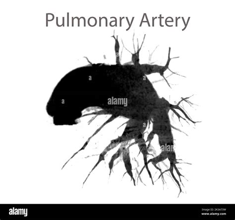 Anatomia Arteria Y Vena Pulmonar Fotografías E Imágenes De Alta