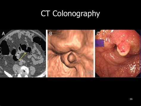 Cats can detect illness in fellow felines through scent and behavior. Can a CT scan detect any abnormal lump in colon? - Quora