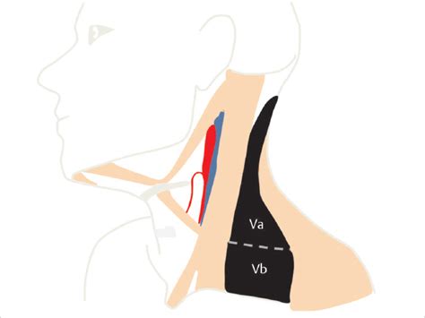 General Overview Of Neck Dissection Ento Key
