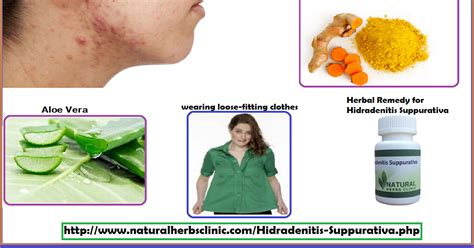 Hidradenitis Suppurativa Treatment Home Remedies