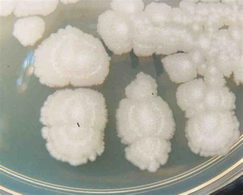 Bacterial Colonies And Streak Plate Free Images And Photographs From