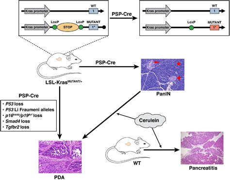 What We Have Learned About Pancreatic Cancer From Mouse Models