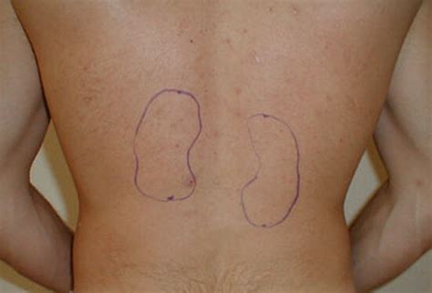 Left side abdomen stomach pain. Kidney Pain and Location - Stones and Vs Back pain