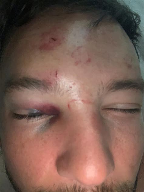 Danny Drinkwater Lashes Out At 16 Year Old Sparking Huge Brawl In