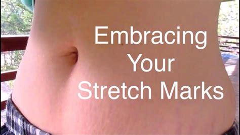 Moms Embrace Your Stretch Marks Youtube