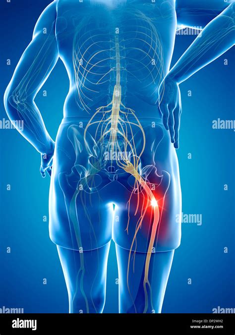 Sciatic Nerve High Resolution Stock Photography And Images Alamy My Xxx Hot Girl