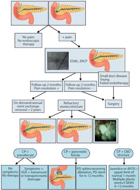 The Role Of Endoscopic And Surgical Treatment In Chronic Pancreatitis