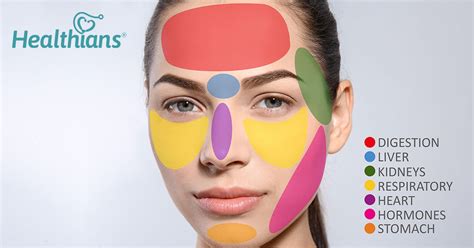 Acne Face Mapping Know What Pimples On Your Face Means