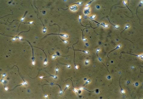 Light Micrograph Of Human Sperm Cells Photograph By Sinclair Stammers