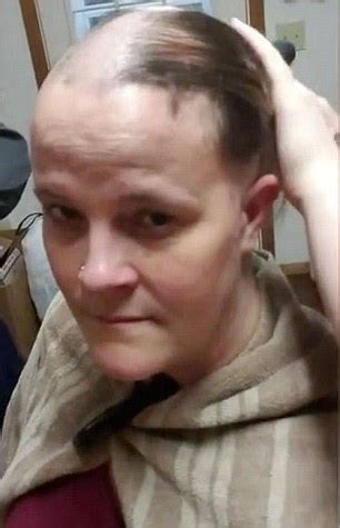 Ohio Woman With Autoimmune Disease Shaves Her Head Daily Mail Online