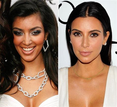 Seit kim kardashian überfallen und ausgeraubt wurde, zieht sie sich aus der öffentlichkeit zurück. Botox und Schönheits-OPs: Stars im Schönheitswahn | Kim ...