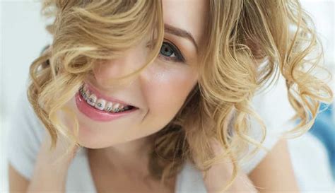 Ceramic Braces Complete Guide With Pros Cons And All Information
