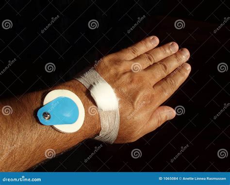 Arm Of A Patient Stock Photo Image Of Medicine Black 1065084