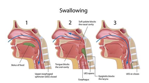 Difficulty swallowing, early morning waking, enlarged or swollen glands and fever webmd symptom checker helps you find the most common medical conditions indicated by the symptoms difficulty. Endoscopic video swallow research and swallowing disorders ...
