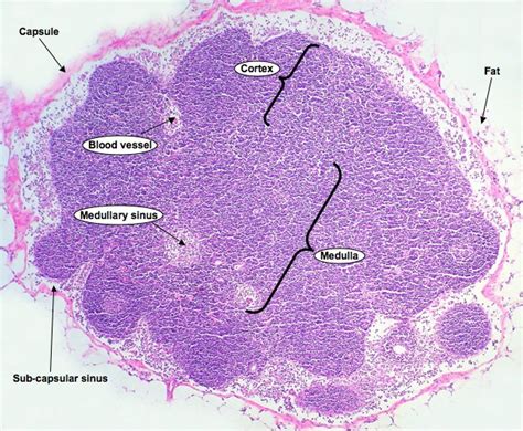 Histoquarterly Lymph Node Histology Blog