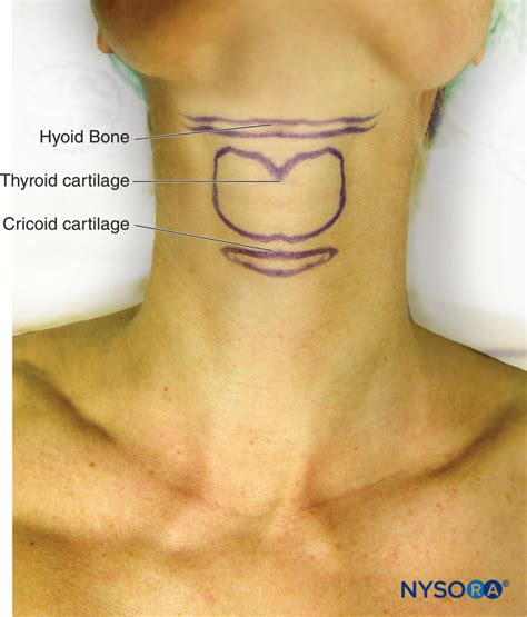 Cricoid Cartilage Thyroid