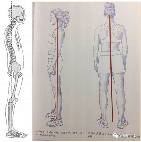 常见不良体态的纠正