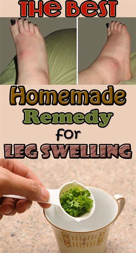 Prevent Leg Swelling And Many Other Diseases With This Amazing Homemade Recipe