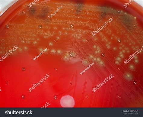 Alpha Hemolysis On Blood Agar Plate Shutterstock