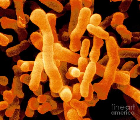 Bifidobacterium Pullorum Photograph By Scimat Pixels