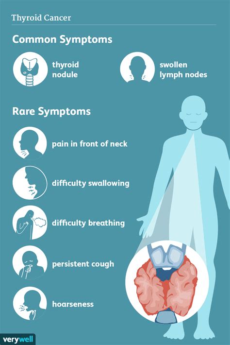 Thyroid Nodule Symptoms Wise Impressed