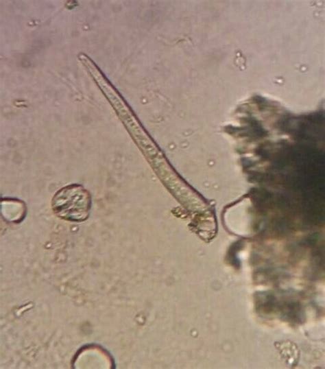 Psidii Folium Fnosi Mikroskopis