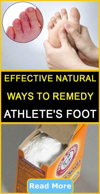 Effective Natural Ways To Remedy Athletes Foot Beauties Natural