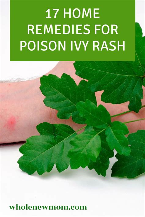 What Is The Best Home Remedy For Poison Ivy