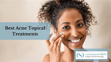Transform Your Skin With These Four Topical Acne Treatments Cumberland Skin