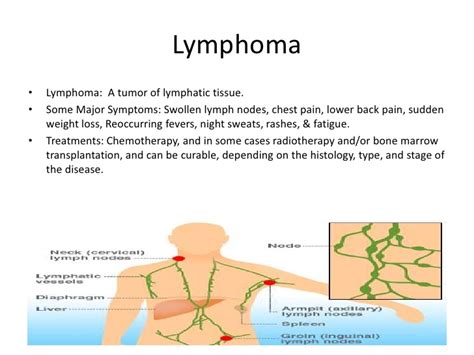 Lymphatic Immune Sys Pres 6