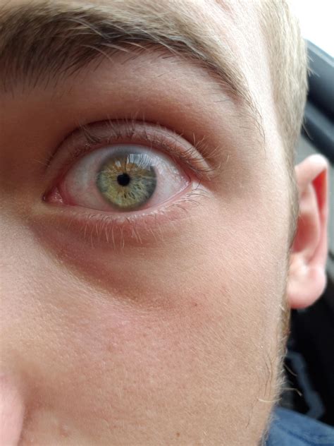 Blue Hazel Or Green Eyes