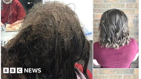 Hairdressers Refuse To Shave Depressed Teens Matted Hair Bbc News