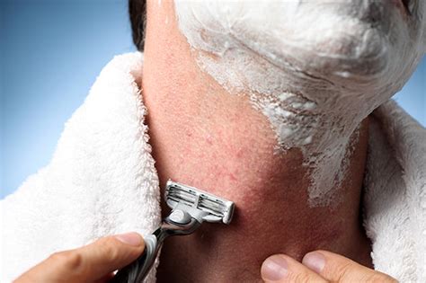How To Prevent Razor Burn Skin Resourcemd
