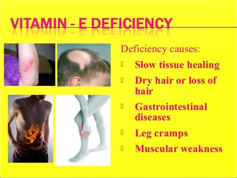 What Are The Symptoms Of A Vitamin E Deficiency Proquestyamahaweb