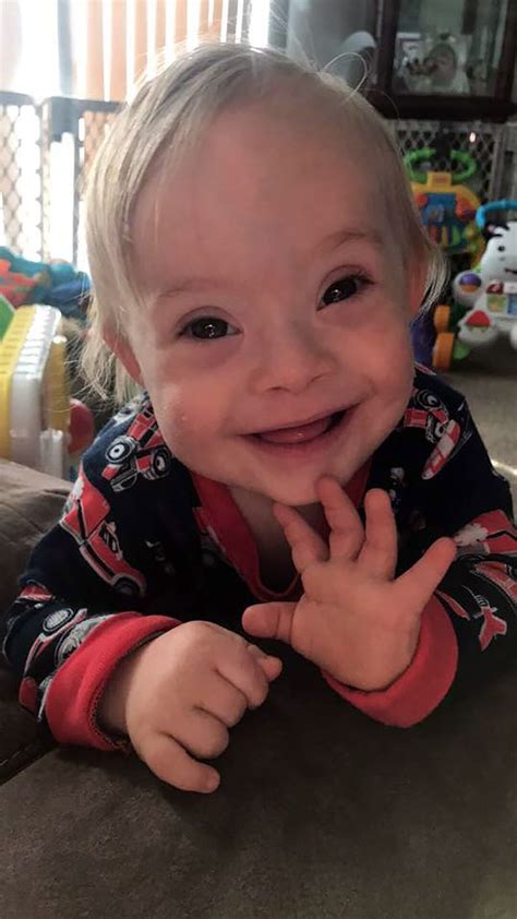 I think a trained professional should be able to advise you the best about what to do and what you will be dealing with with a downs syndrome child. Adorable boy becomes first 'Gerber Baby' with Down's ...