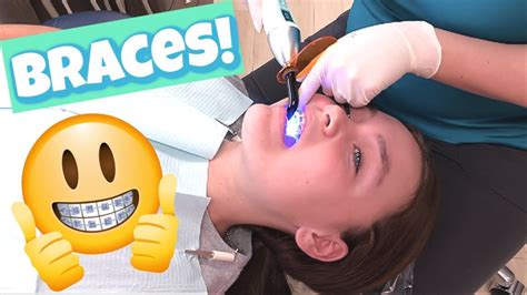 Mya Gets BRACES The Process Of Getting BRACES At The Orthodontist YouTube