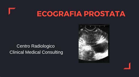 L Ecografia Alla Prostata è Dolorosa Clinical Medical Consulting